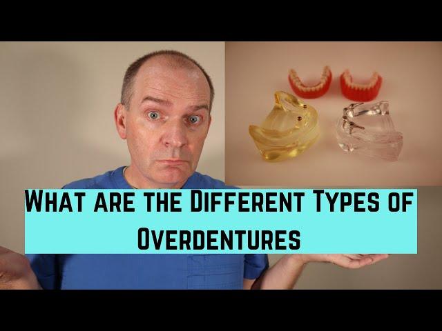 What are the different types of overdentures