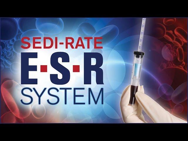 Sedi-Rate ESR System from Globe Scientific