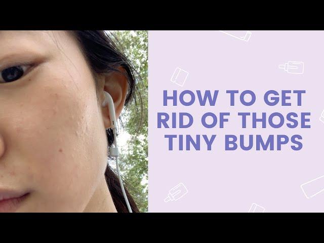 How to Get Rid of Those Tiny Bumps | FaceTory