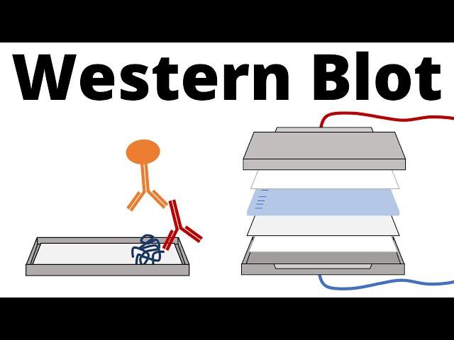 Western Blot / Protein Immunoblot explained