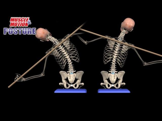 Lateral Flexion - Postural Assessment