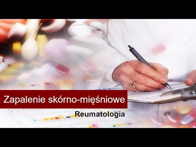 Zapalenie skórno-mięśniowe – przyczyny, objawy, diagnostyka, leczenie, rokowanie