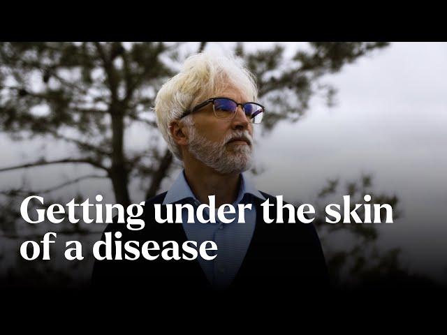 Getting under the skin of a disease - Nature's Building Blocks | BBC StoryWorks