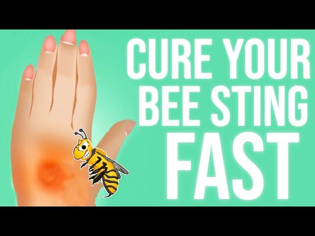 How To Treat a Bee Sting in 2024