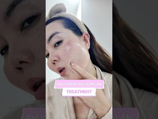 Serum phục hồi sau xâm lấn, laser, treatment, retinol, peel da, sẹo rỗ tại nhà #trinhmeow