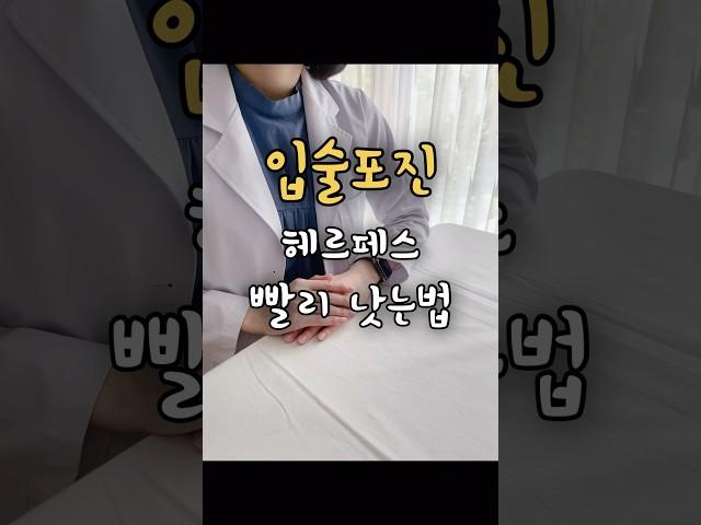 헤르페스 입술물집 하루만에 빨리 낫는 법 (입술포진) #아시클로버 #아시크로버 #포지넨 #티로클 #티로트리신