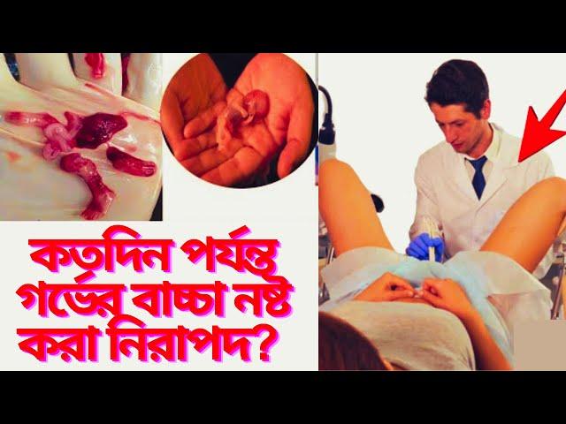 কতদিন পর্যন্ত গর্ভের বাচ্চা নষ্ট করা নিরাপদ? কত দিনের বাচ্চা নষ্ট করা যায়? কি কি সমস্যা হয়? দেখুন