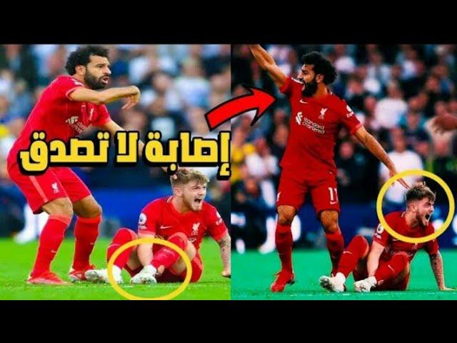 اصابه خطيره للاعب #ليفربول #هارفي إليوت فيمباراة اليوم وخروجه من الملعب