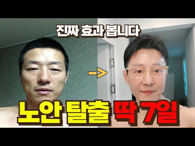 20분만 해보세요. 1,300만뷰의 얼굴 나이 10년 젊어지기. 10년 넘게 지키는 루틴!(빼먹으면 늙음)