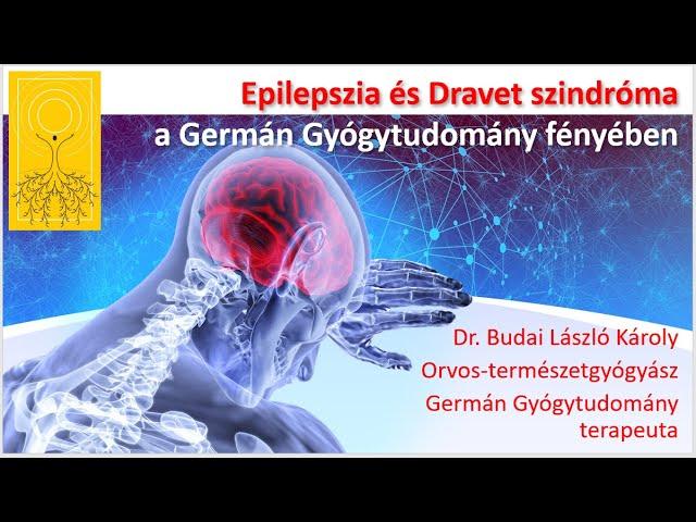 Epilepszia és Dravet szindróma a Germán Gyógytudomány fényében