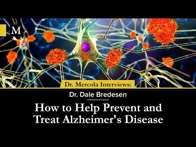 How to Help Prevent and Treat Alzheimer's Disease – Interview with Dr. Dale Bredesen