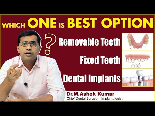 Best Teeth Replacement Options | Fixed Teeth vs Removable Teeth | Eledent Dental Hospitals