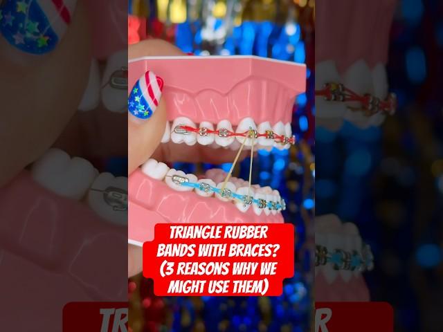 TRIANGLE RUBBER BANDS WITH BRACES? #braces #teeth #asmr