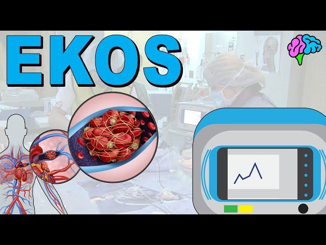 EKOS Endovascular System EXPLAINED!