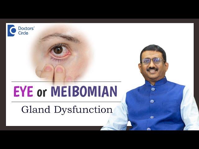 Emerging Treatment for Dry Eye from Meibomian Gland Dysfunction-Dr.Sriram Ramalingam|Doctors' Circle