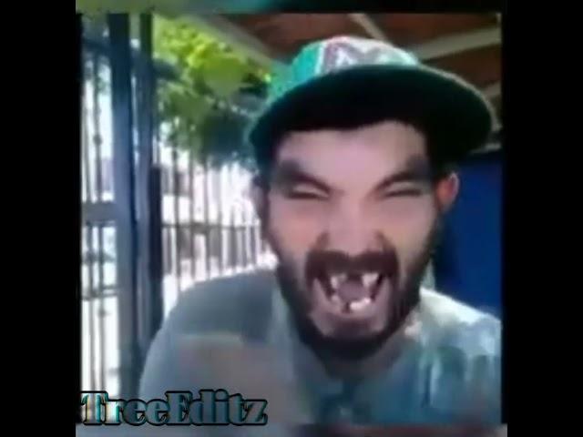 Thr best Laugh #edit @TreeEditz-b4v