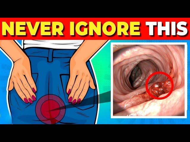 Silent Signs of Colon Cancer You MUST Not Ignore!