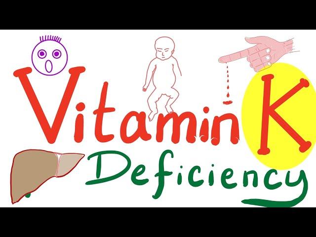 Vitamin K Deficiency - Hemorrhagic Disease of the Newborn (HDN)