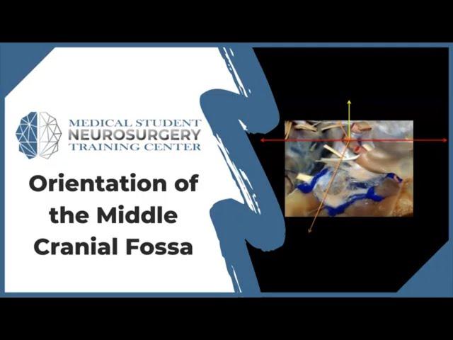 Orientation of the Middle Cranial Fossa - Neurosurgery Training Center