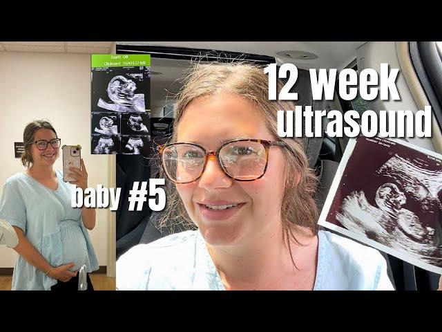 REUPLOADED: HCG levels update & my 12 weeks appointment