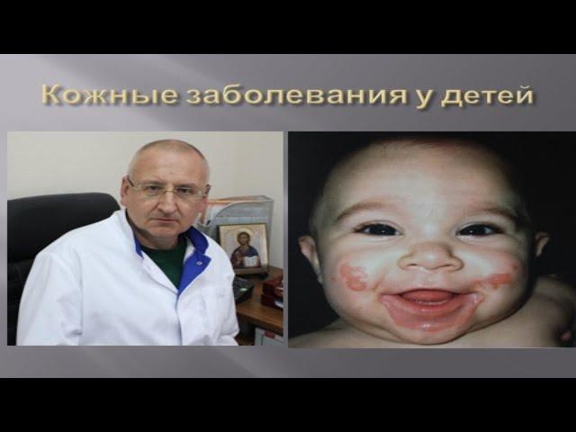 Кожные заболевания у детей - виды, причины, лечение