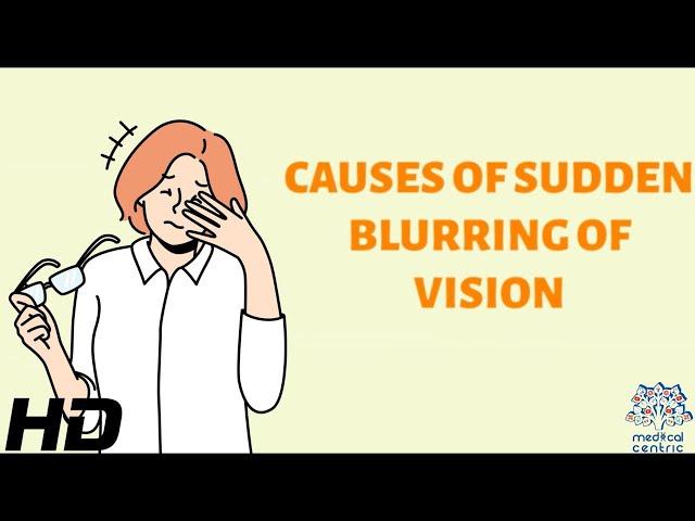 Unveiling the Mystery: The Science Behind Sudden Blurring of Vision