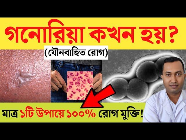 Ghonorrohea | গনোরিয়া রোগের ঔষধ কি ? গনোরিয়া কি এমন কেন হয় | গনোরিয়া | Ghonorrohea Symptoms |