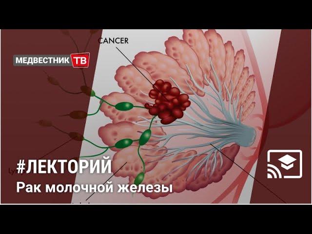 Школа клинициста: Рак молочной железы