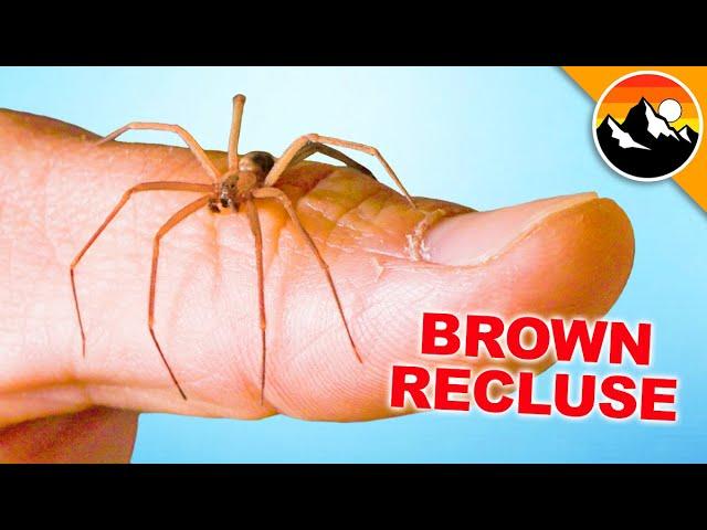 Will it Bite Me?! Handling a Brown Recluse!