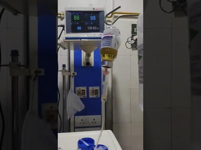 #gbs #plasmapheresis#neurology #medicos #medicine