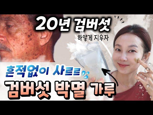 악질 검버섯도 박멸시켜 주는 00가루팩!! 주2회 꼬박꼬박  꾸준하게 하시면 옅어지고 예방됩니다!! 50세이후라면 필수예요!!