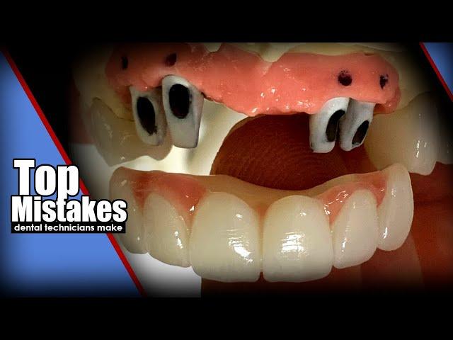 Top Mistakes Dental Technicians Make Episode 1