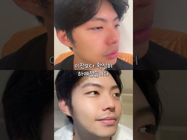 하얀피부 연예인들 사이 유행이라는 미백제품 #미백 #앰플 #미백앰플 #미백크림 #추천