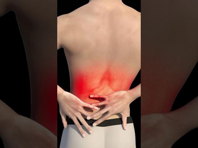 This is a bulging Disc #shorts #back  #anatomy