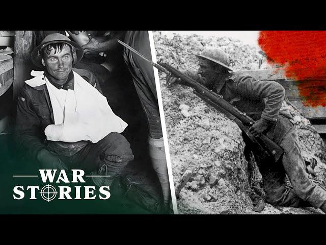 Why Trench Warfare Was The Most Traumatising Form Of Fighting | History Of Warfare | War Stories