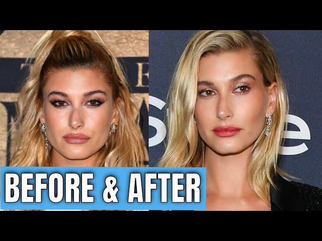 Hailey Bieber: Plastic Surgery