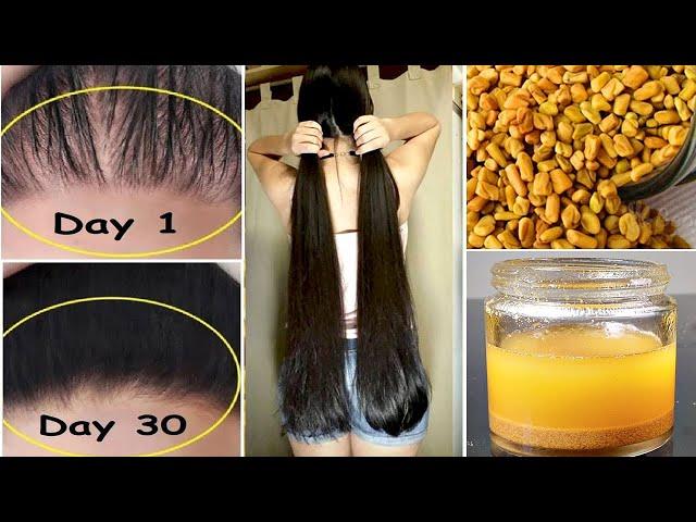 15 Days Challenge  - Extreme Hair Growth | World's Best Faster Remedy for Hair Growth