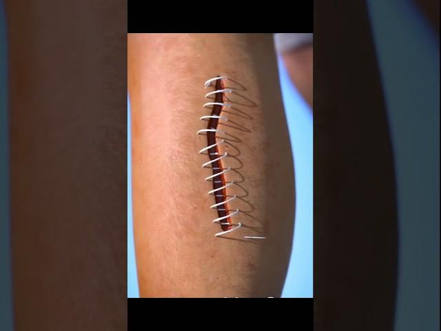 how stitches works on skin || #shorts #hindi #science