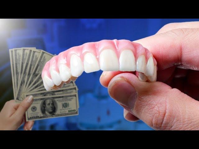 Full Mouth Dental Implants. Cost and Comparison