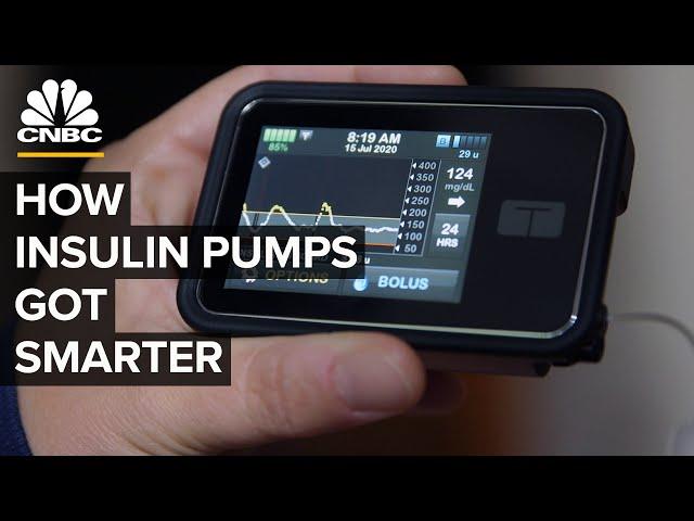 How High-Tech Insulin Pumps Make Managing Diabetes Easier