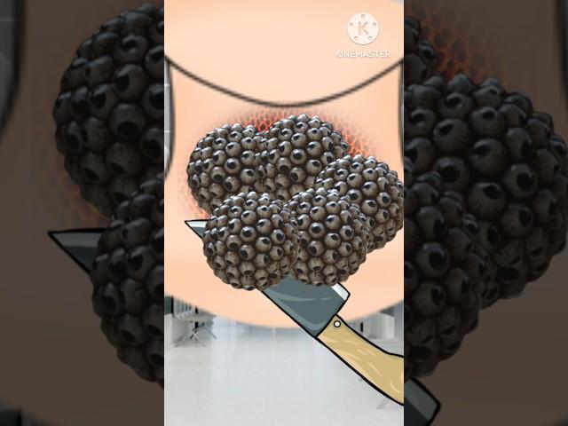 ASMR neck triphobia removing #asmr #animation  #viral #shorts