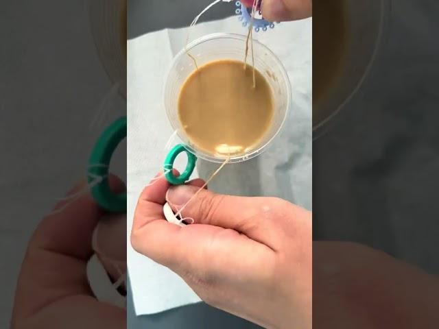 Coffee VS Braces  #bracesadjustment #bracescolours #orthodontist