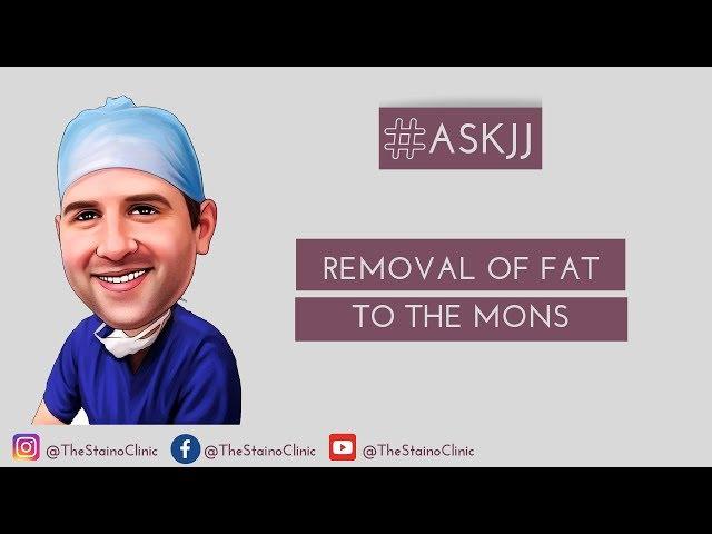 Removal of fat to the mons