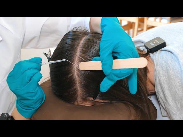 ASMR Perfectionist SCALP Check with BAD Results and TREATMENT (Real Person)