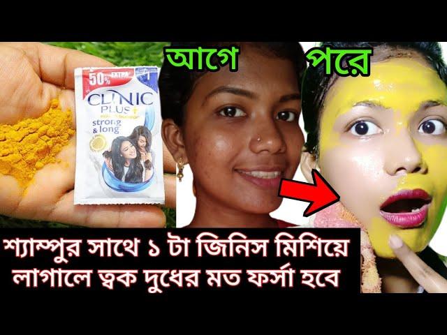 শীতের সেরা গ্লো ফেসিয়াল একদিনে ত্বক ফর্সা টানটান হবে বয়েসের ছাপ মুছে যাবে/Winter Glass skin facial