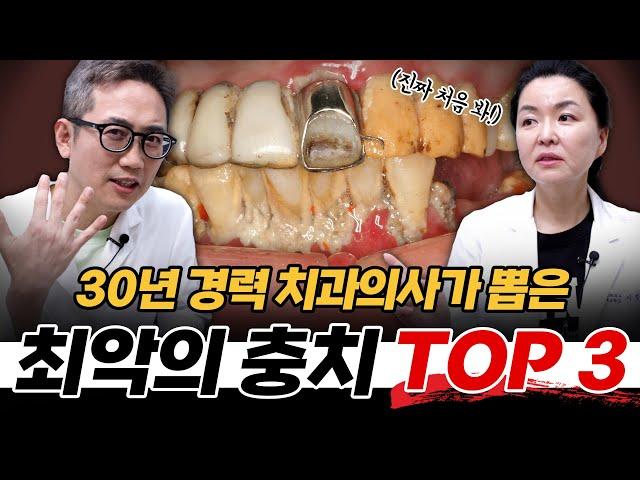 치과의사가 뽑은 역대급 충치 환자 Top 3!!