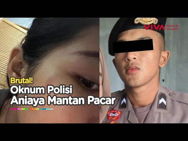 Oknum Polisi Anggota Polda Jabar Diduga Aniaya Pacar