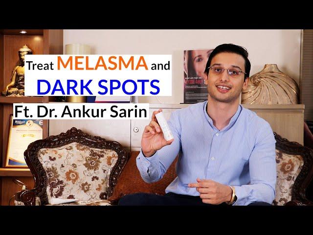 How to treat melasma, hyperpigmentation, & dark spots | Dr. Ankur Sarin ft. Fixderma