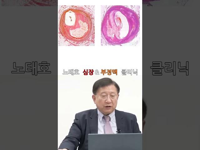 노태호의심장이야기