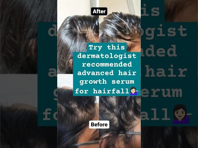 I Tried a Dermatologist-Recommended Hair Growth Serum #shortsfeed #shorts #ytshorts #hairgrowth